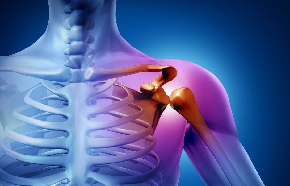 injury to the shoulder joints due to osteoarthritis
