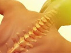 osteochondrosis - spinal cord disease