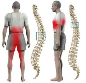 Creeping up the spine